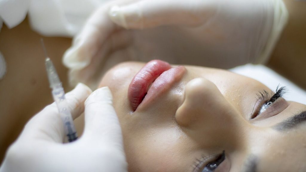Lip Fillers Cost